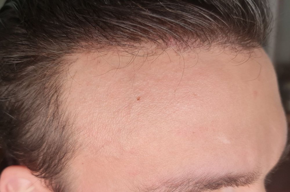 Hattingen Hair8.jpg