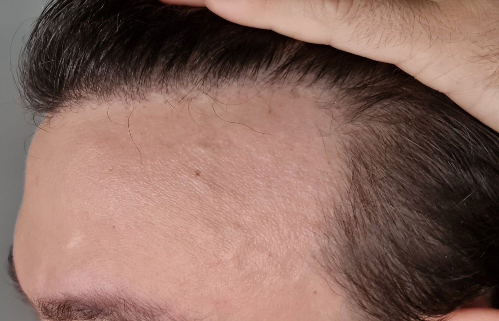 Hattingen Hair9.jpg