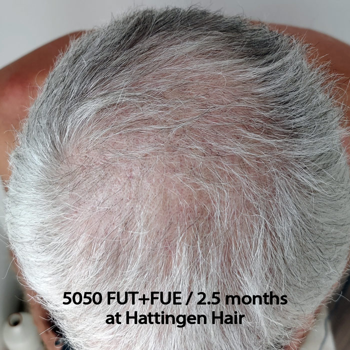 hattingenhair5050FUTFUE-above.jpg
