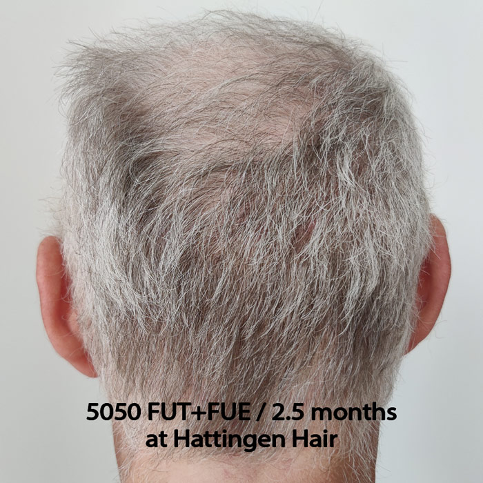 hattingenhair5050FUTFUE-dec-back.jpg