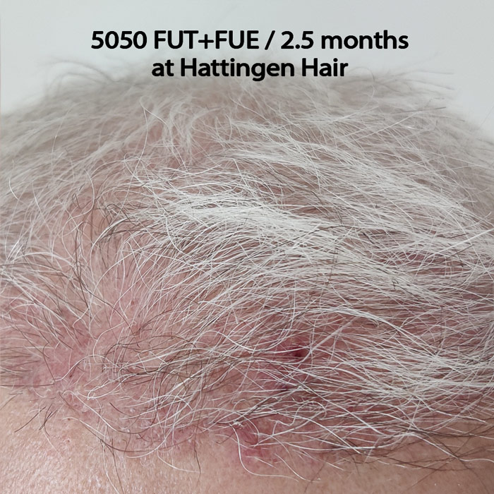 hattingenhair5050FUTFUE-front.jpg
