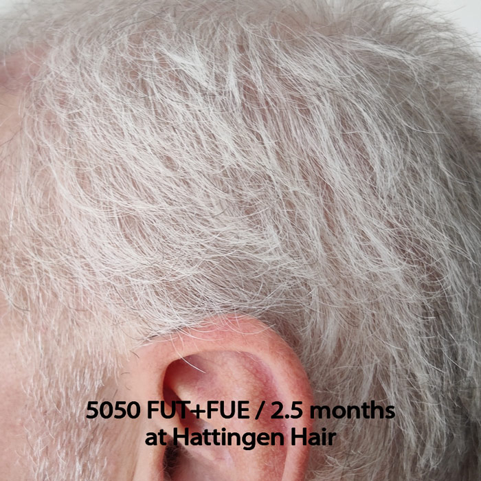 hattingenhair5050FUTFUE-side.jpg