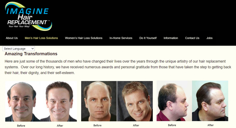 Imagine Hair Replacement Texas.png