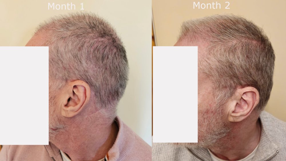 left month1 v month2.jpg