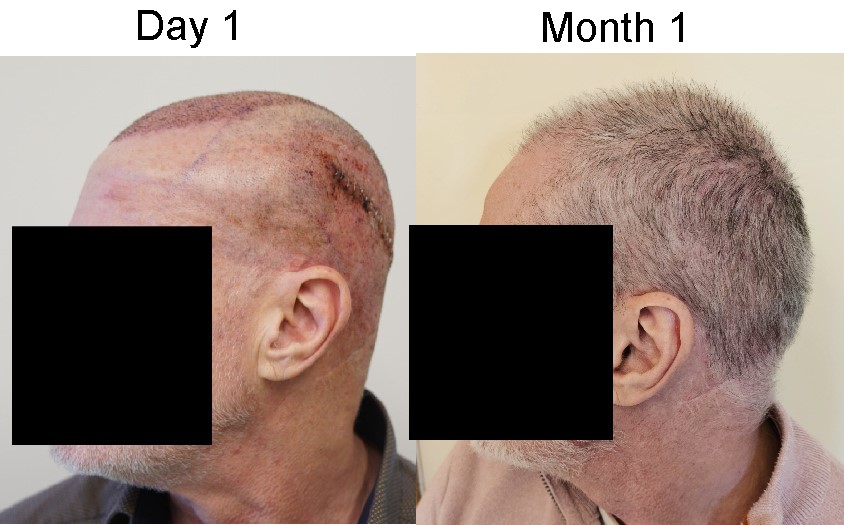 left side month 1.jpg