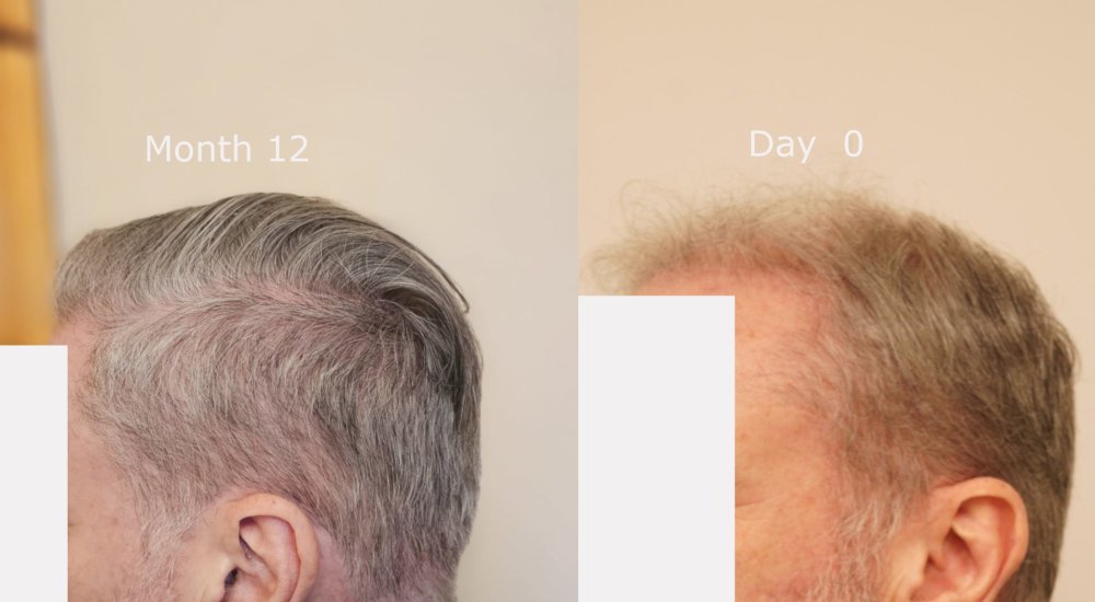 left side month12 v Day 0.jpg