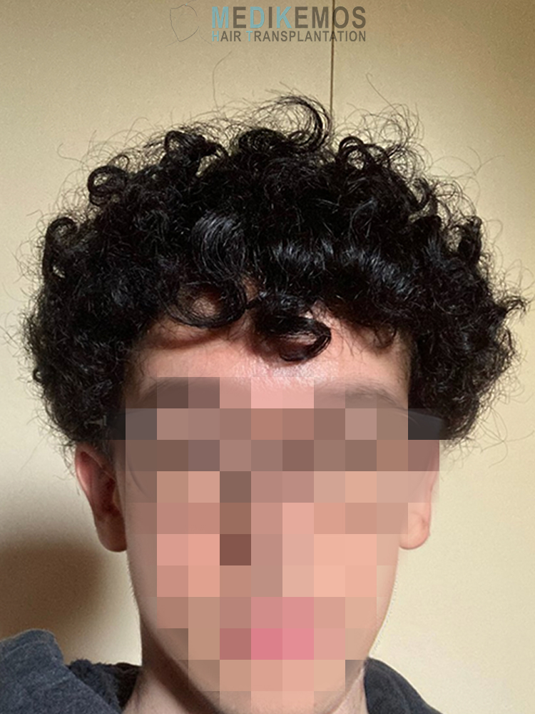 LG-10MONTHS-1.jpg