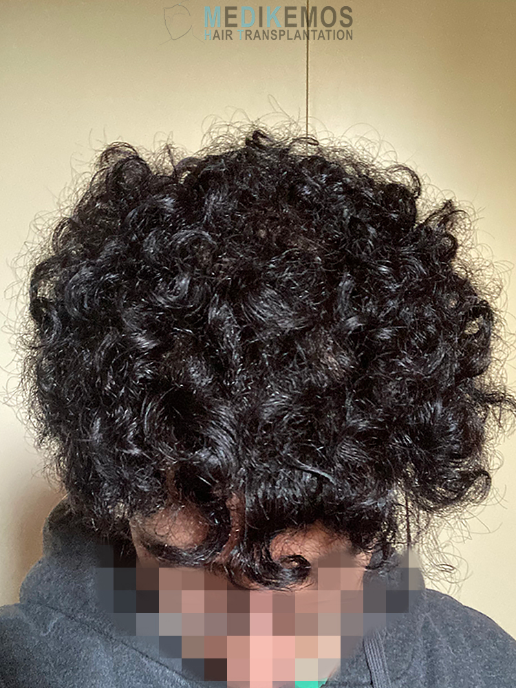 LG-10MONTHS-2.jpg