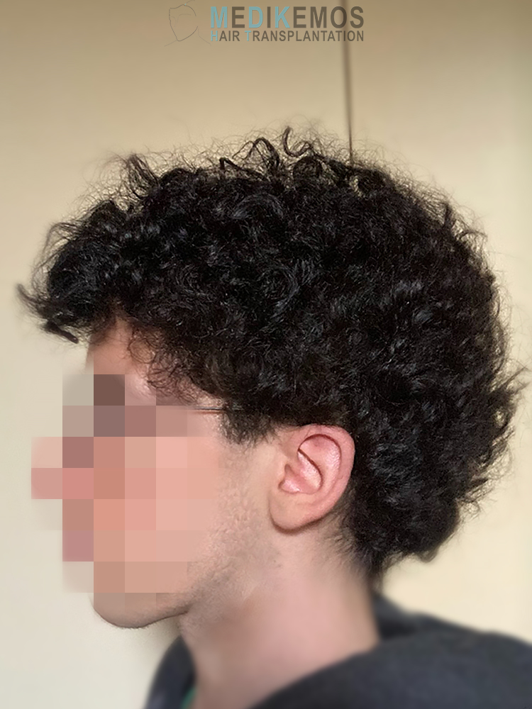 LG-10MONTHS-3.jpg