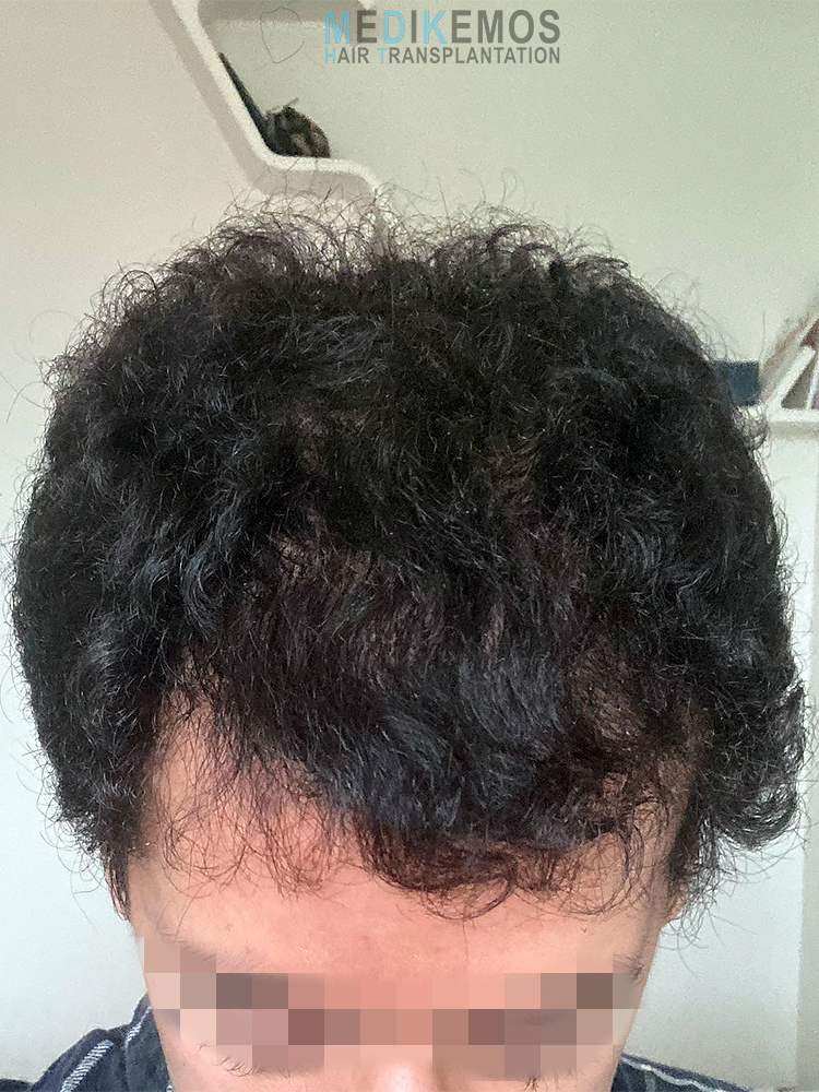 LG-6MONTHS1.jpg
