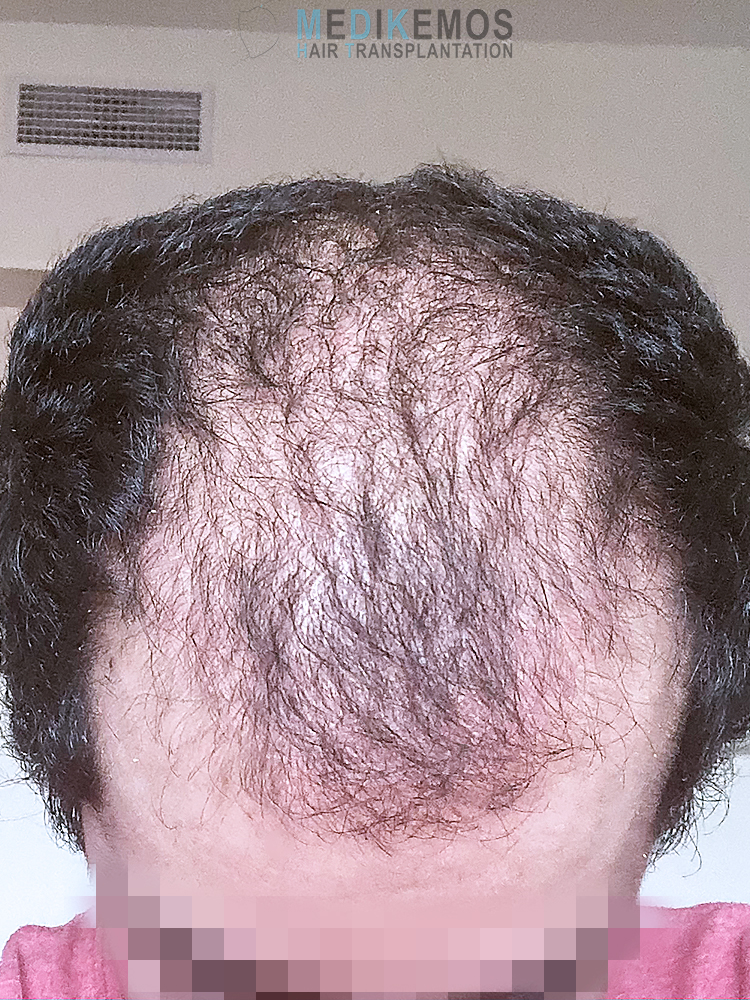 LG_2MONTHS-1.jpg
