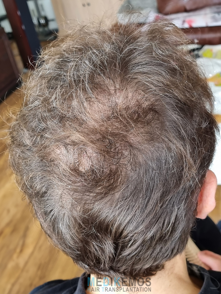 MM-9months_1.jpg