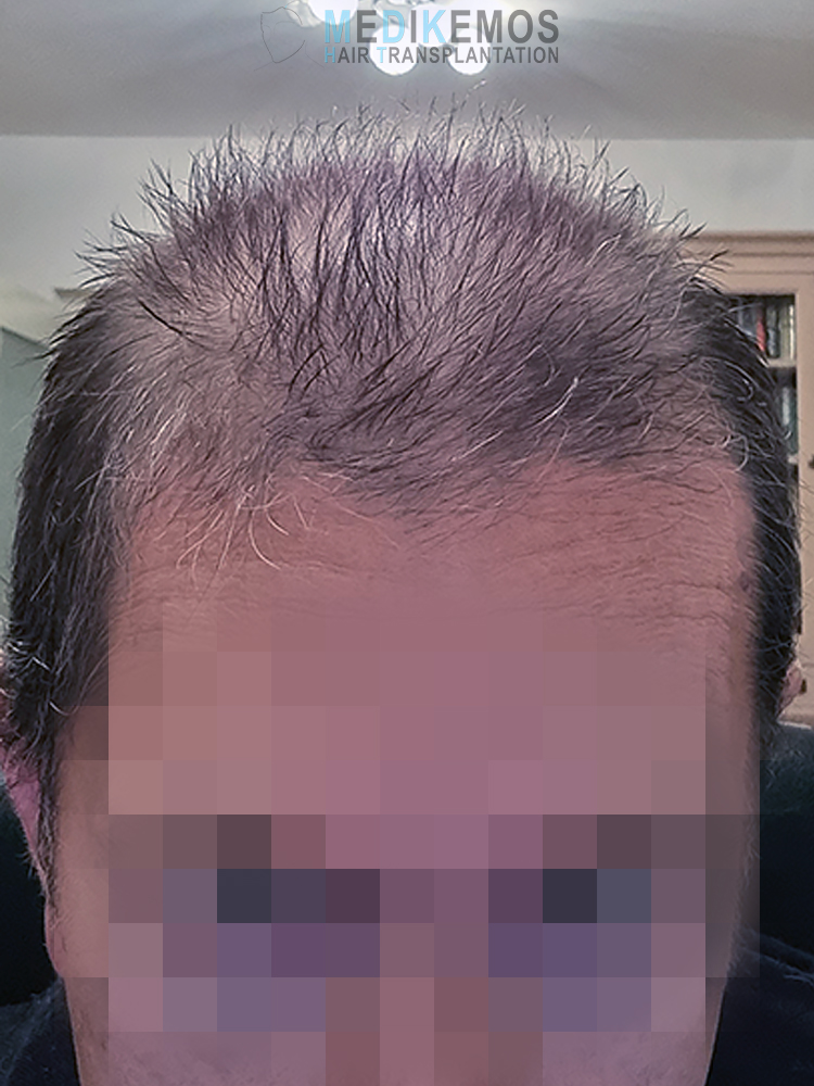 MM_2MONTHS-1.jpg
