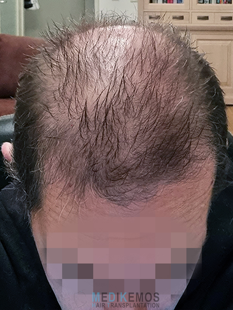 MM_2MONTHS-2.jpg