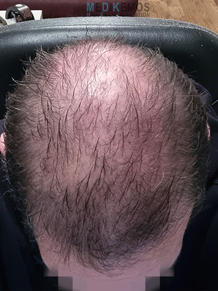 MM_2MONTHS-3.jpg