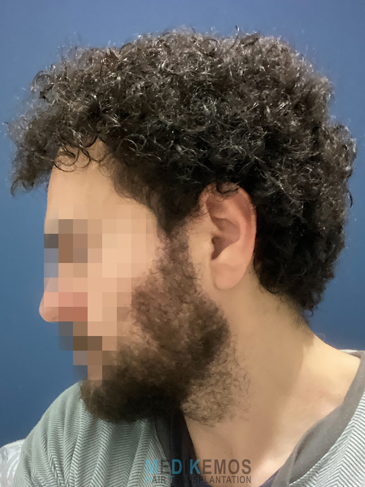 NM_14MONTHS-X1_2.jpg