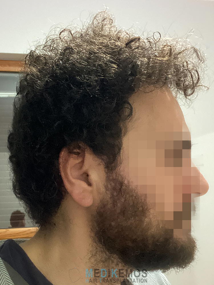NM_14MONTHS-X1_3.jpg