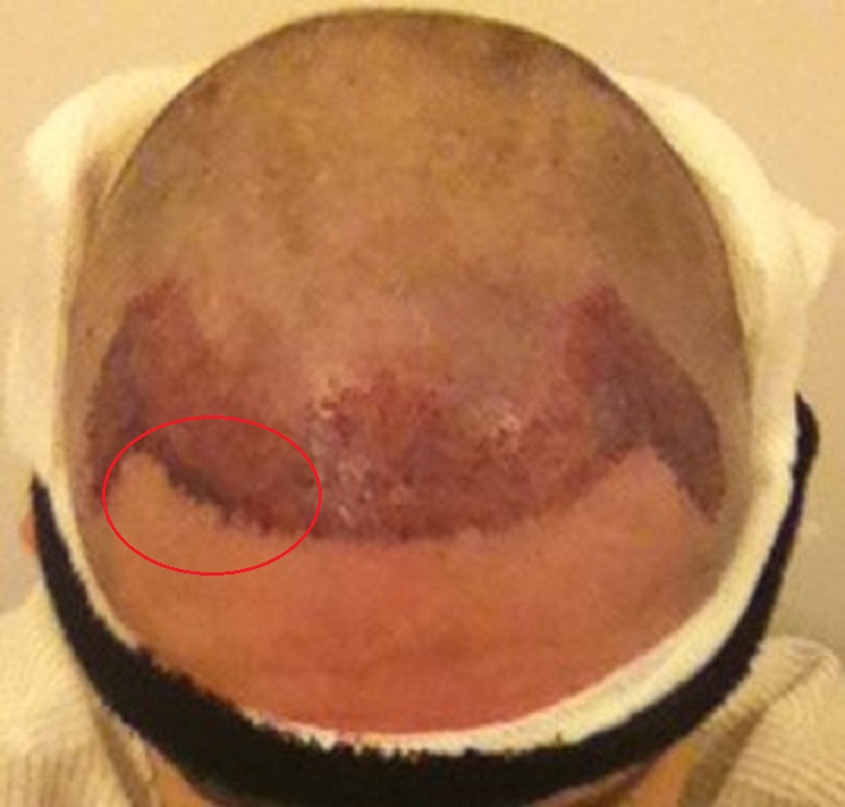 OP finished.jpg