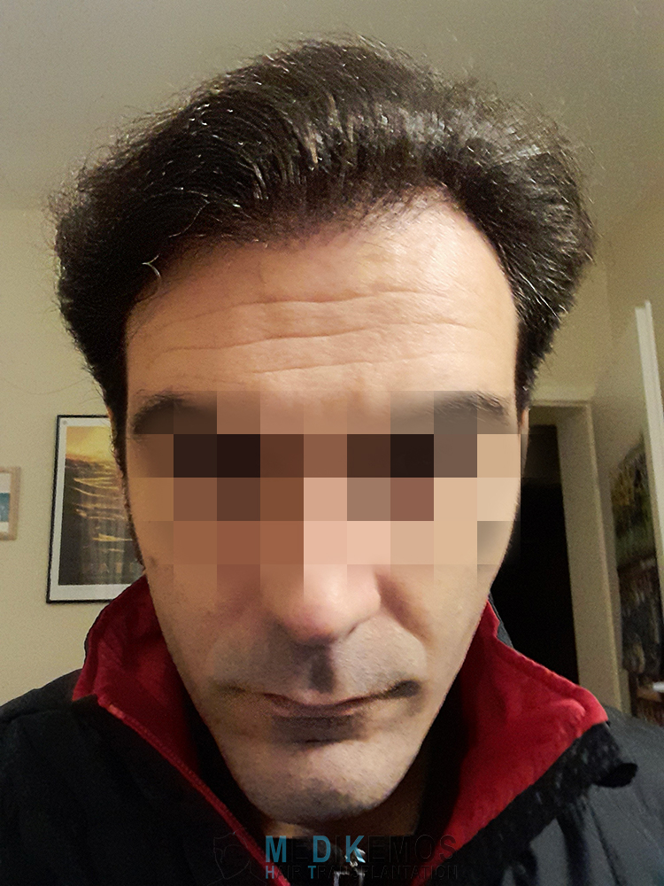 PD_12months-1.jpg