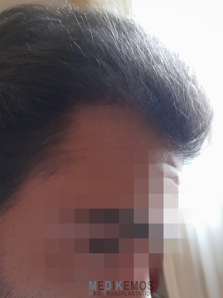 PD_5monthsW-X1-1.jpg