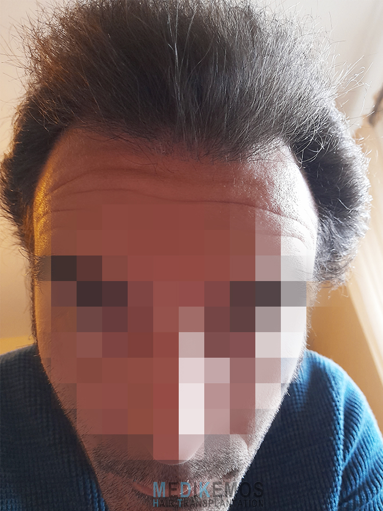 PD_5monthsW-X1-3.jpg