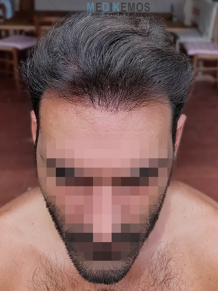 PD_9monthsW-X1-1.jpg