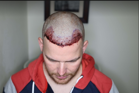 post op.jpg