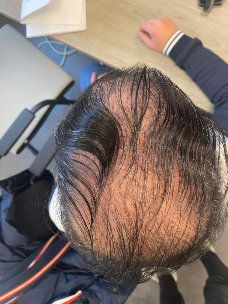 pre 3rd surgery November 2024.jpeg