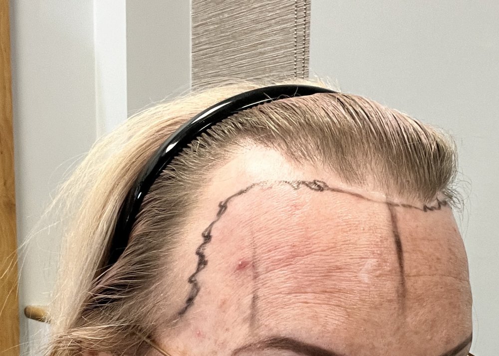 preop2.JPG