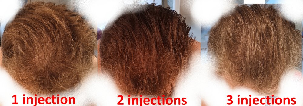 progress_dessussec_3injections.jpg