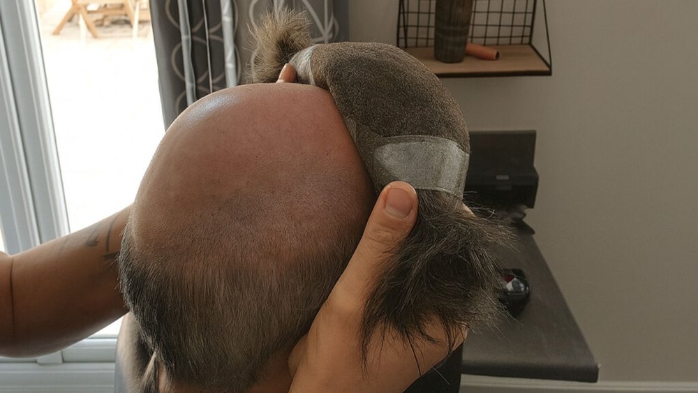 Putting on a hair system.jpg