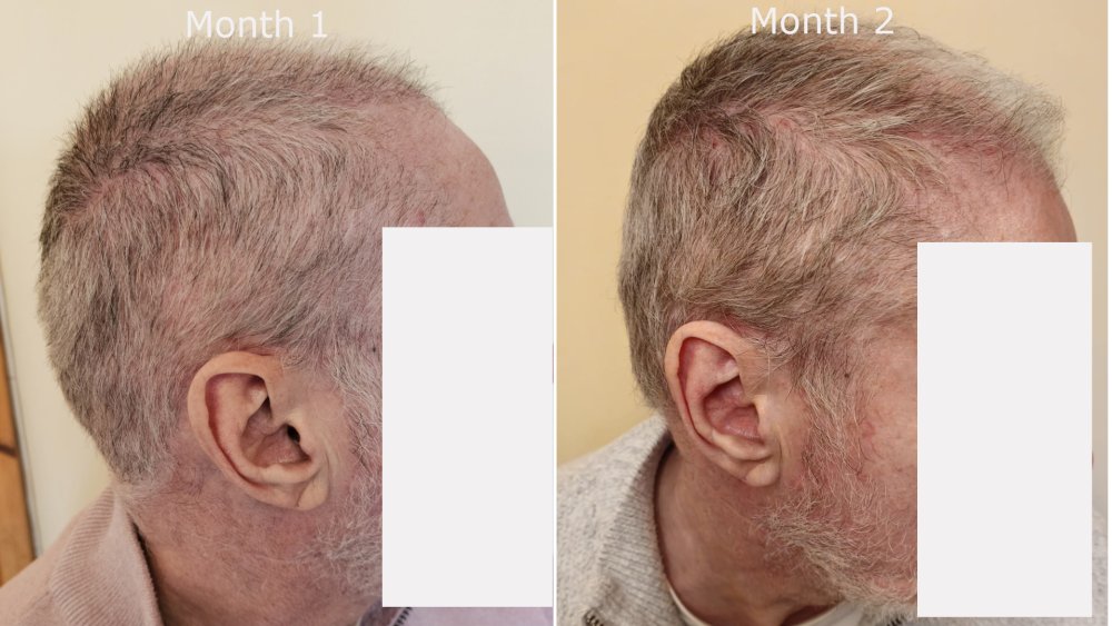 right month1 v month2.jpg