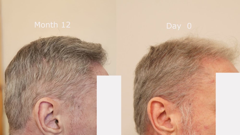right side month12 v Day 0.jpg