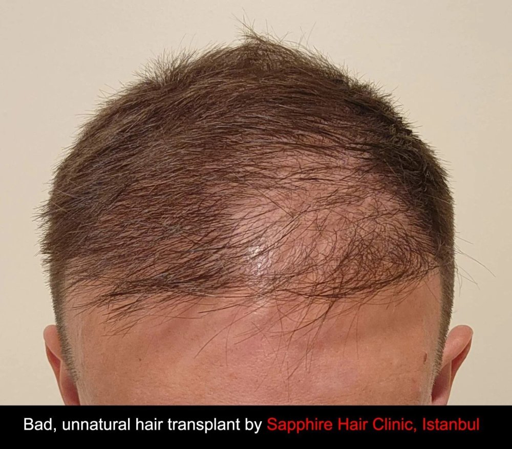 sapphire_hair_clinic_1.jpg