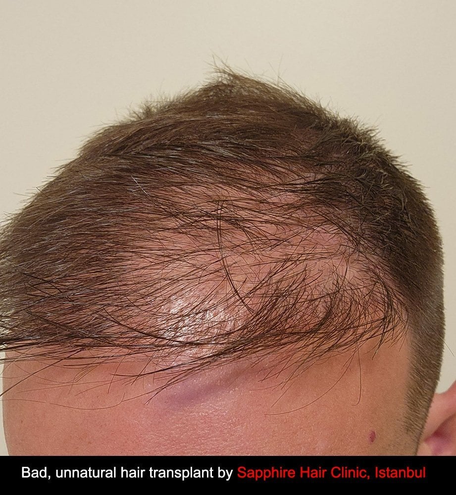sapphire_hair_clinic_2.jpg