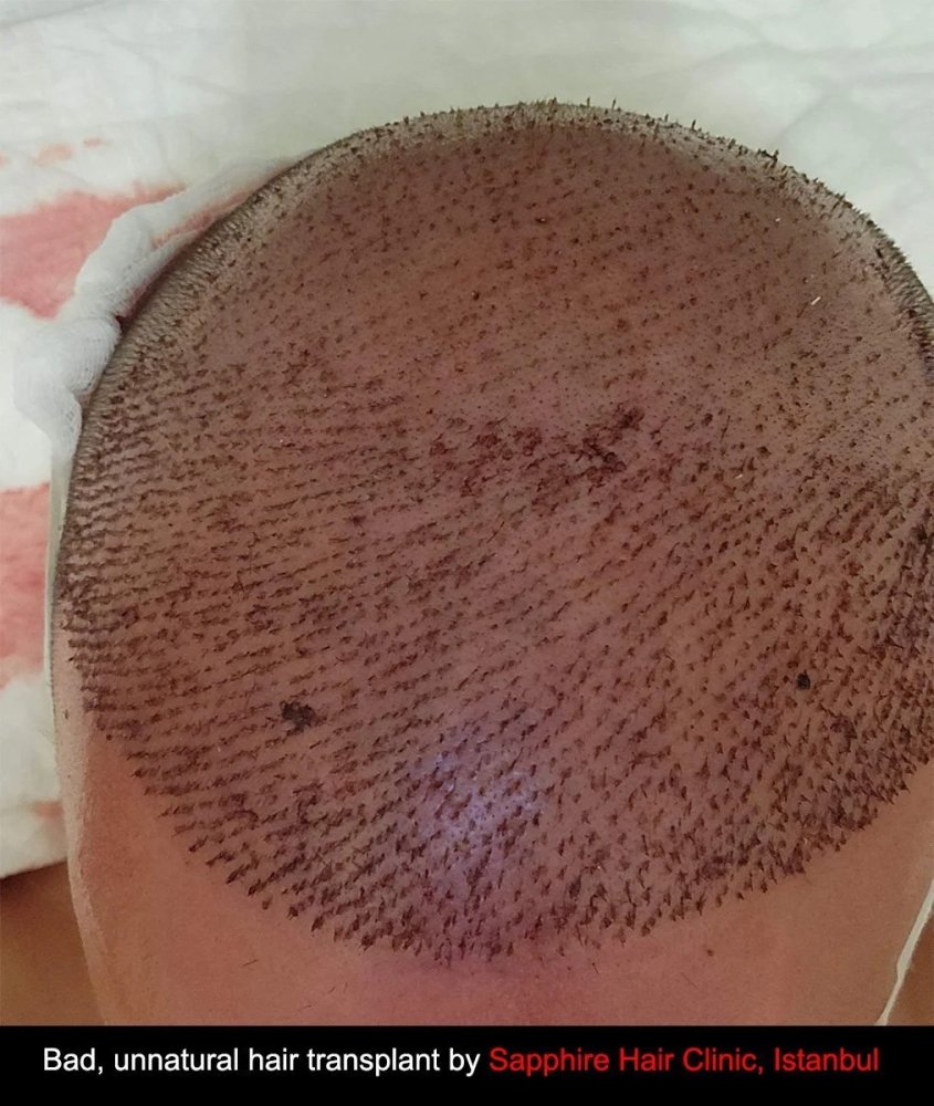 sapphire_hair_clinic_3.jpg