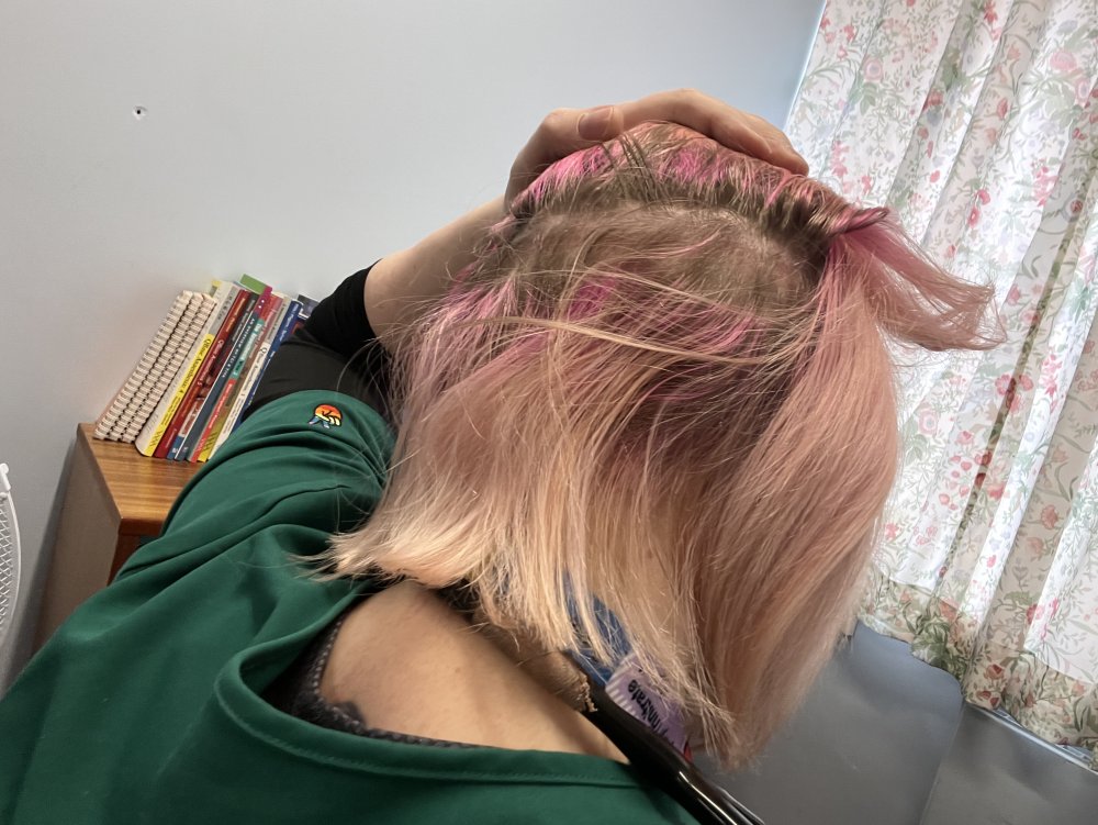 scar.jpg