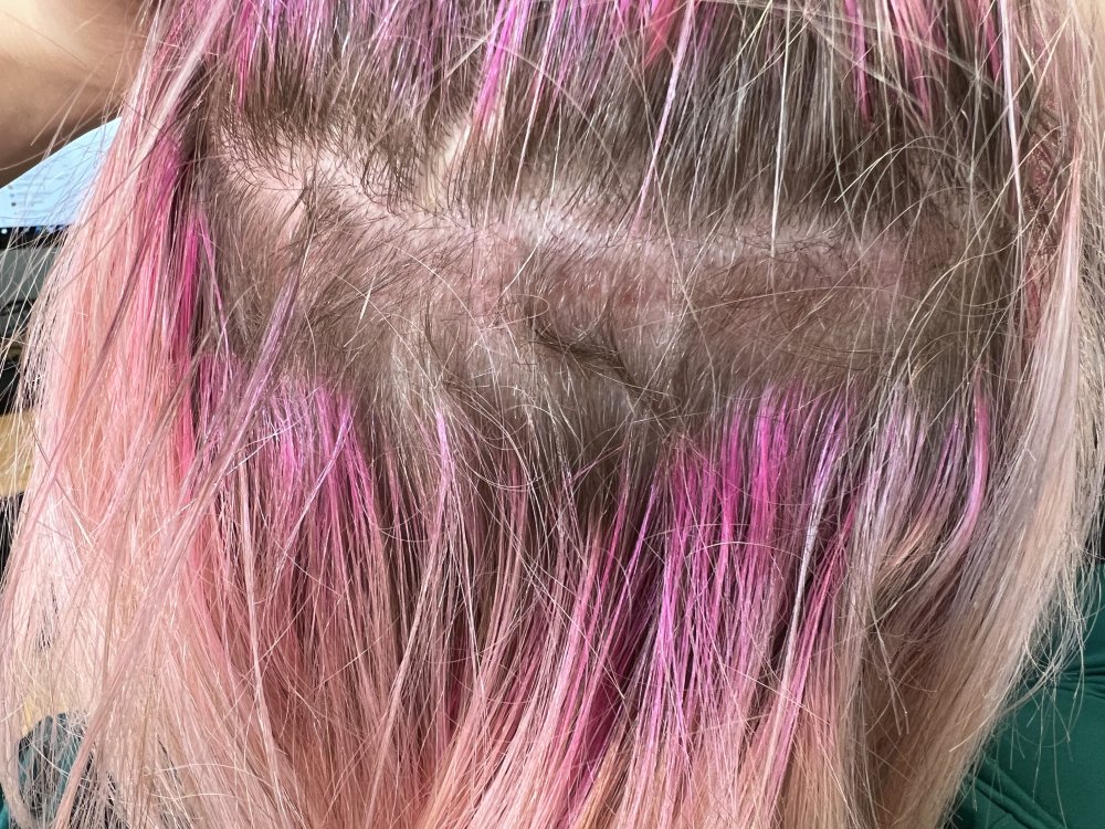 scar2.JPG