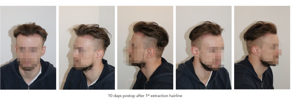 Scherm­afbeelding 2025-11-05 om 18.51.42.png