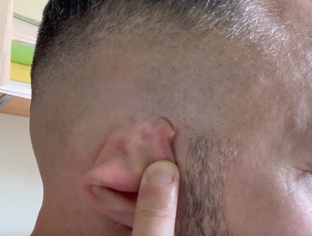Shaved hair.jpg
