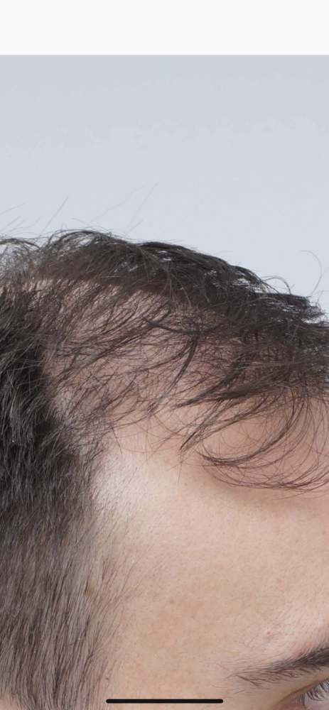 Side view.png