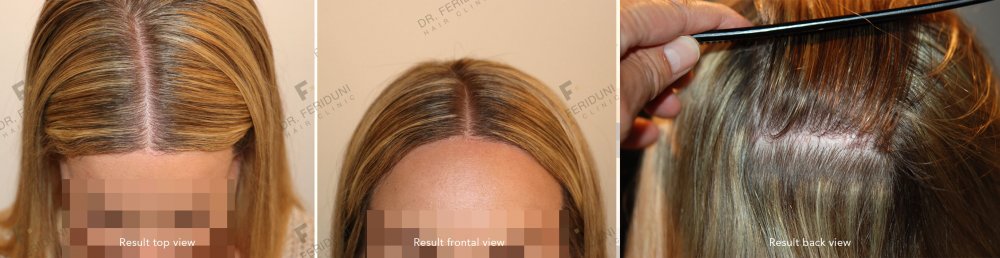SK14.jpg