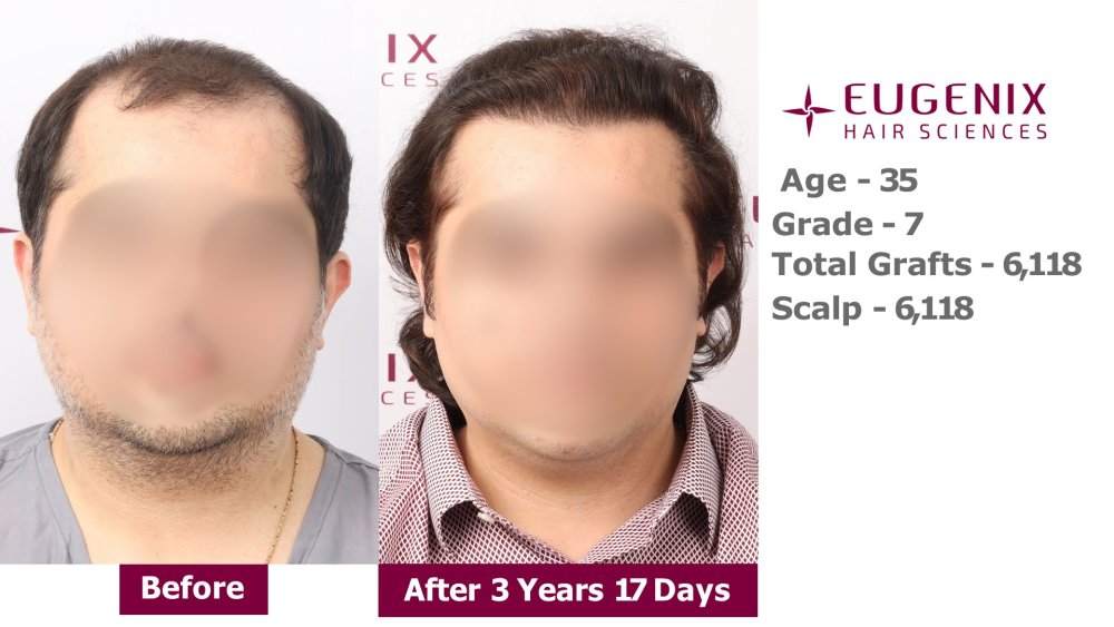 Slide 1.jpg
