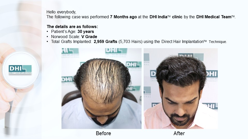 Slide2.JPG