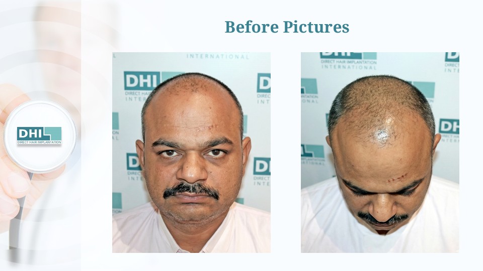 Slide2.JPG