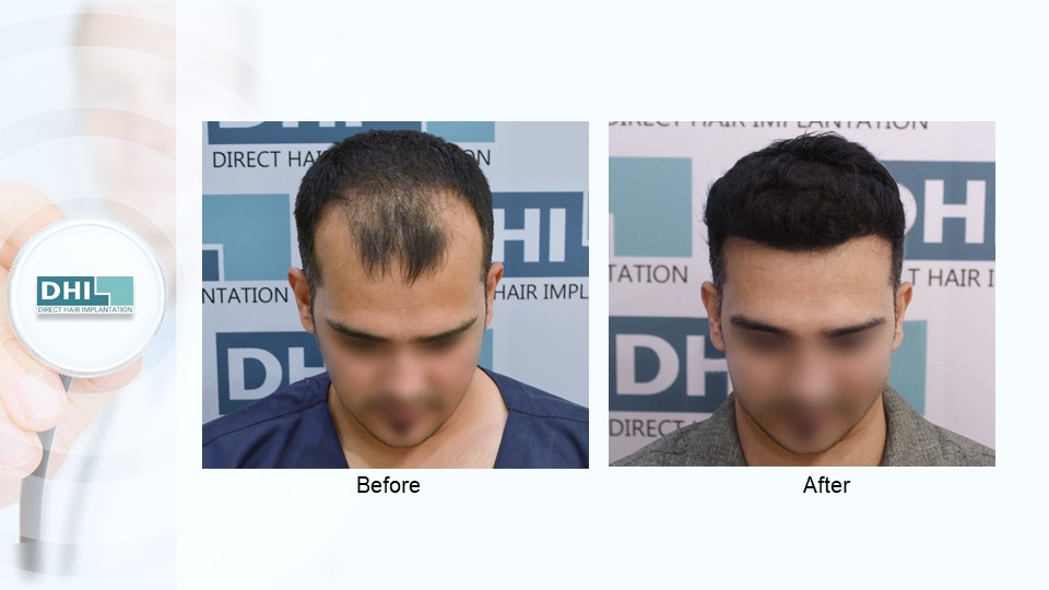 Slide3.JPG