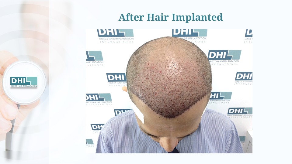Slide4.JPG