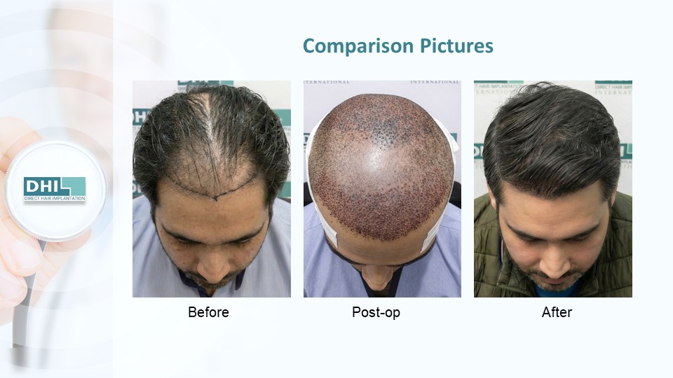 Slide7.JPG