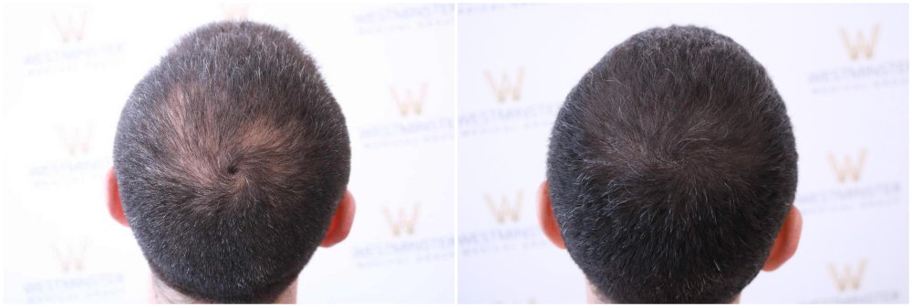 SMP Crown Westminster Medical Group.jpg