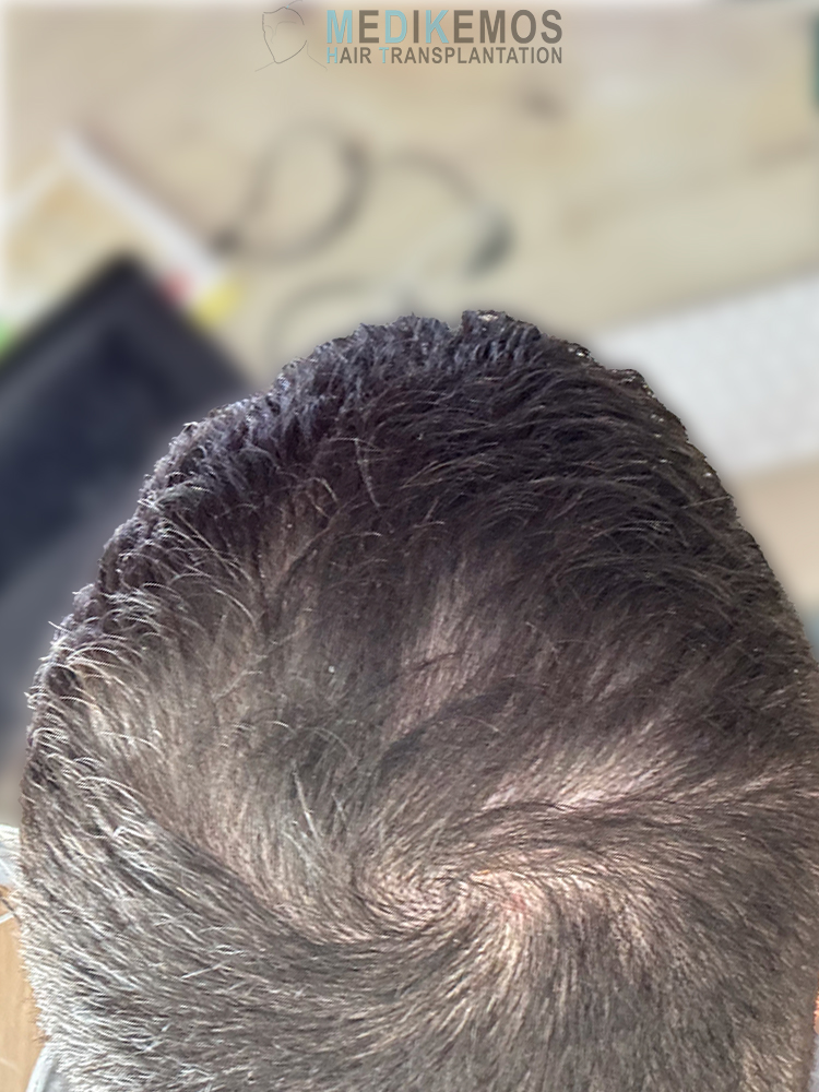 SP-12months-5.jpg